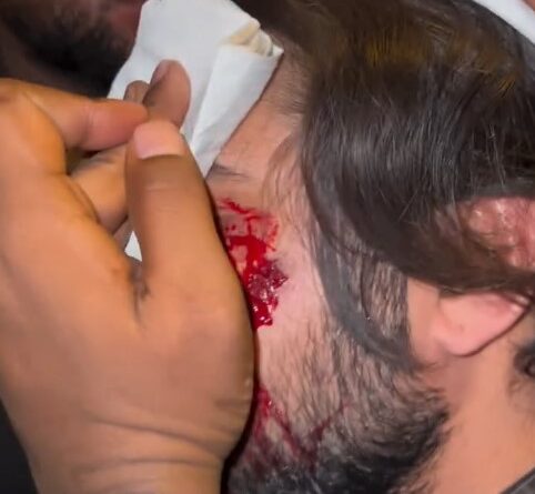 Punjabi Singer Khan Saab Injured During Shooting की खबर ने फैंस को चिंता में डाल दिया। जालंधर में नए गाने की शूटिंग दौरान कांच टूटने से खान साब घायल हो गए और उनके माथे पर टांके लगे।